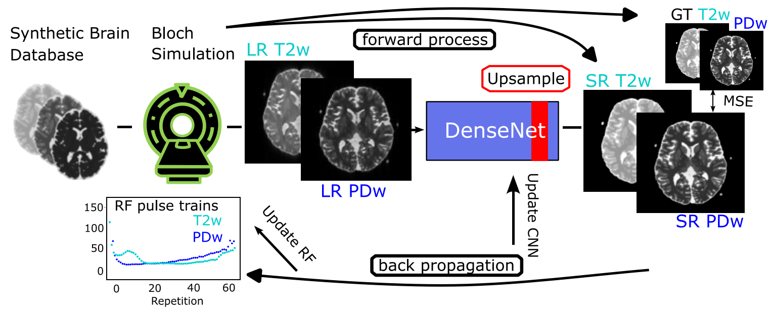 mri-superres-teaser.png